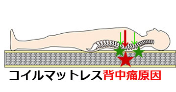 コイルスプリングマットレス腰痛、背中、体痛い理由と治し方北海道、札幌，