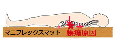 マニフレックスマットレス腰痛、背中痛くなる理由と治し方北海道、札幌，